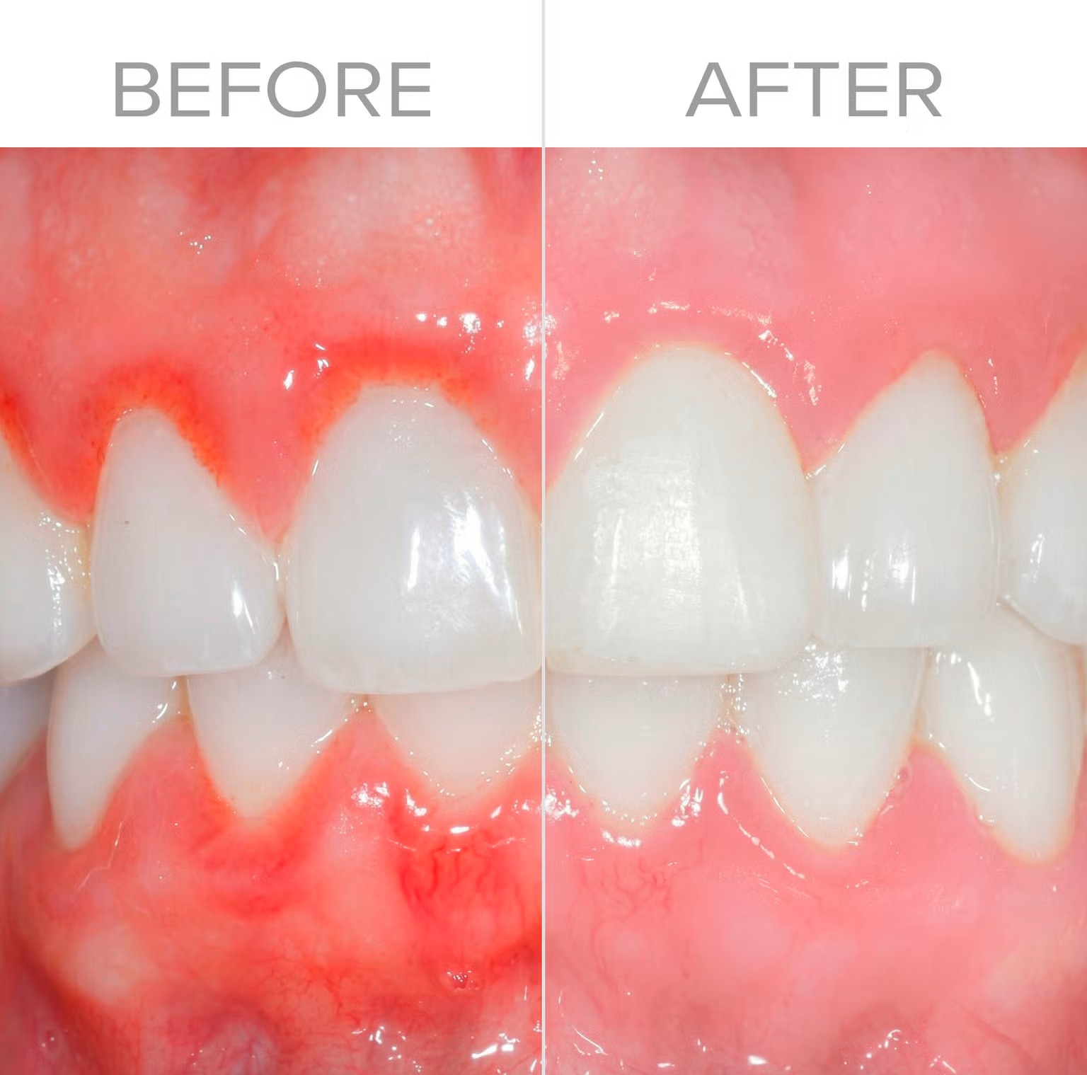 Great Gums BioElectric Toothbrush Benefits