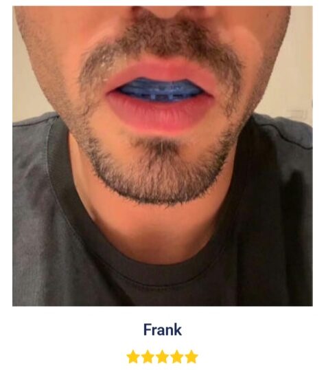 Sleepzee Anti Snoring Mouthpiece Customer