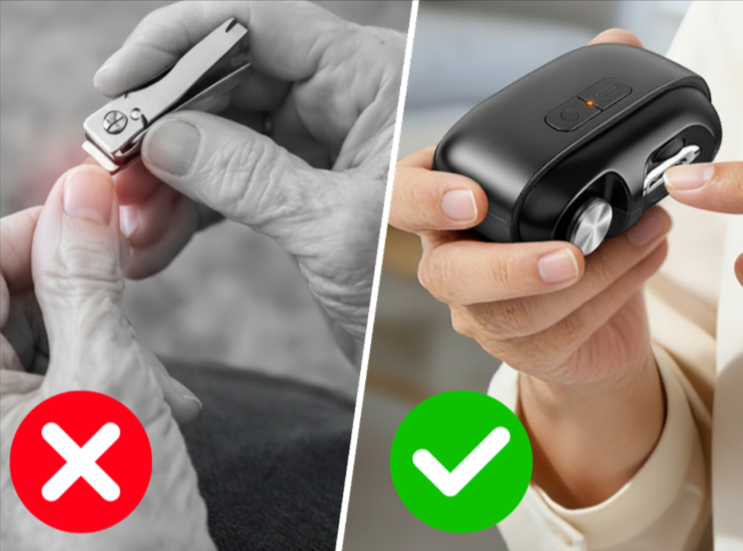 Vital Electric Nail Clipper Benefits