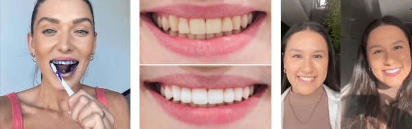 WellaWhite Teeth Whitening Foam customer reviews